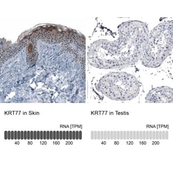 Cytokeratin, LMW Antibody, Novus Biologicals:Antibodies:Primary Antibodies